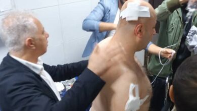 استشهاد شرطي وإصابة ضابط في حمص جراء انفجار عبوة ناسفة – S A N A