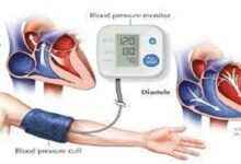 اليوم العالمي لارتفاع ضغط الدم.. تعرف على شروط قياس نسبته