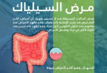&Quot;تجمع الرياض الصحي&Quot; يوضح 4 أعراض لمرض &Quot;السيلياك&Quot;