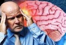 لا تتجاهل هذه العلامات المبكرة.. 6 أعراض تكشف الإصابة بورم المخ