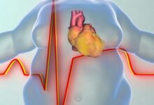 ما العلاقة بين الإصابة بقصور القلب وزيادة الوزن؟.. اعرف الحقيقة