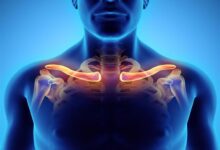 متلازمة مخرج الصدر.. الأعراض والأسباب