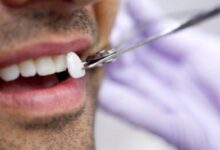 ثورة علمية في طب الاسنان .. دواء يعيد نمو أسنان الإنسان من جديد