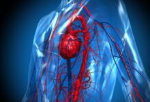 أسباب متلازمة القلب المنكسر وأعراض تستدعي زيارة الطبيب
