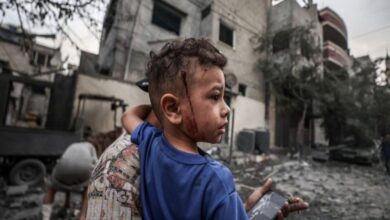 شاهد.. 10 أطفال يفقدون ساقا أو ساقين في غزة يوميا