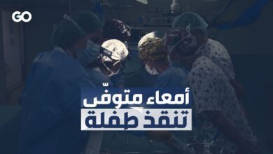 نجاح أول عملية زرع أمعاء في العالم لطفلة في مستشفى بإسبانيا