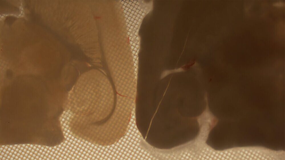 علماء يعيدون إحياء خلايا المخ بعد التجميد الشديد لأول مرة