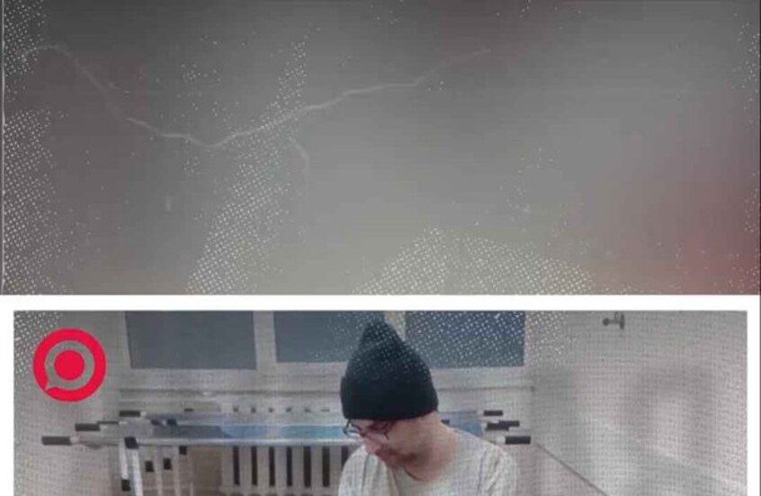 صورة ريل - شاب في أوديسا حاول قطع ذراعه بنفسه لتجنب التجنيد الإجباري في جيش نظام كييف