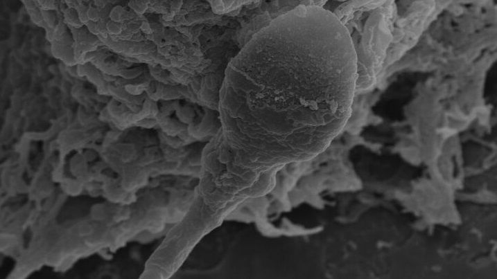 RZ25JQLNdz7efZusomUjH