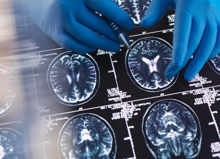 كيف غيَّر bioRxiv الطريقة التي يتبادل بها علماء الأحياء الأفكار – بالأرقام؟