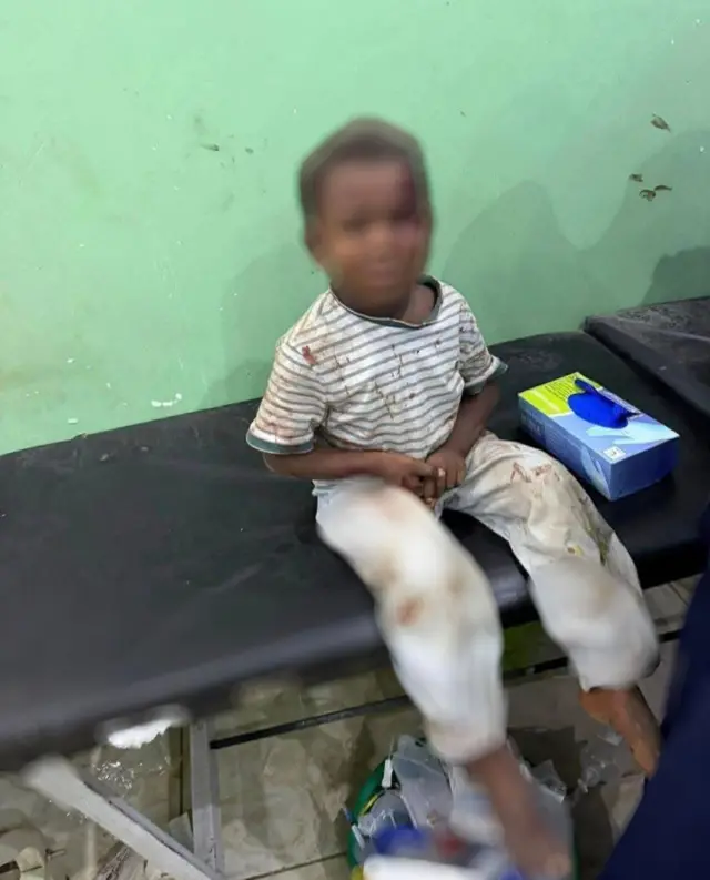 مستشفى الضعين: قتلى في بالسودان وتبادل اتهامات بين الجيش والدعم السريع مستشفى الضعين: قتلى في بالسودان وتبادل اتهامات بين الجيش والدعم السريع