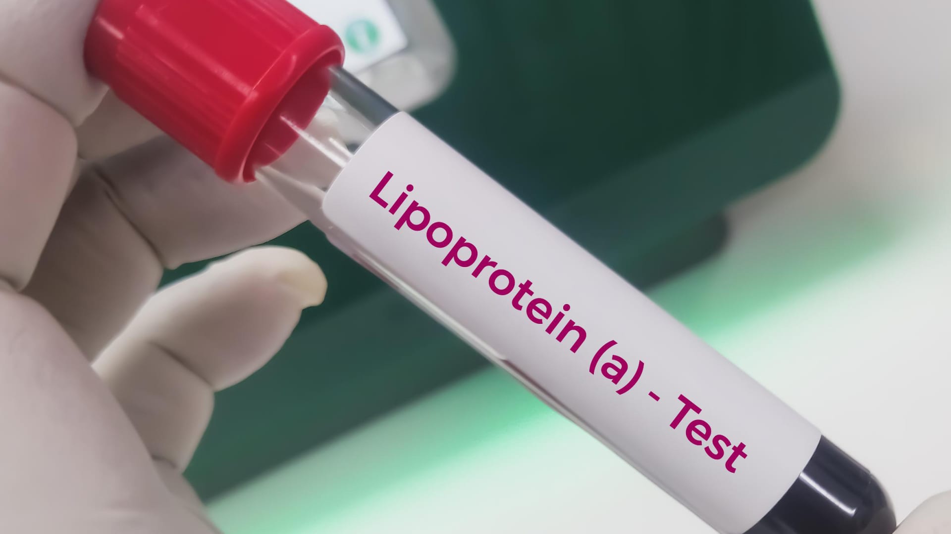 108297645 1777300177064 108297645 1777300126332 gettyimages 1902456631 20231205 225708 4595 jpg