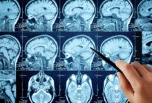 8E56B4B0F37011220C4Cfa045E9A24F545861D77 Jpg