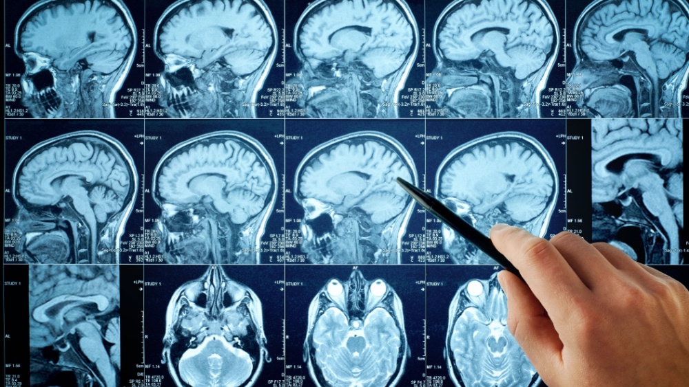 8e56b4b0f37011220c4cfa045e9a24f545861d77 jpg