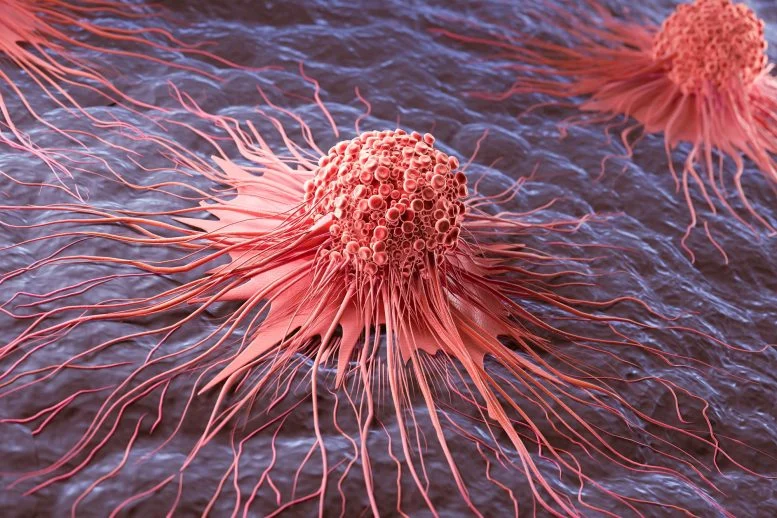 Cancer Cell Spread Abnormal Growth 777  215 518 jpg