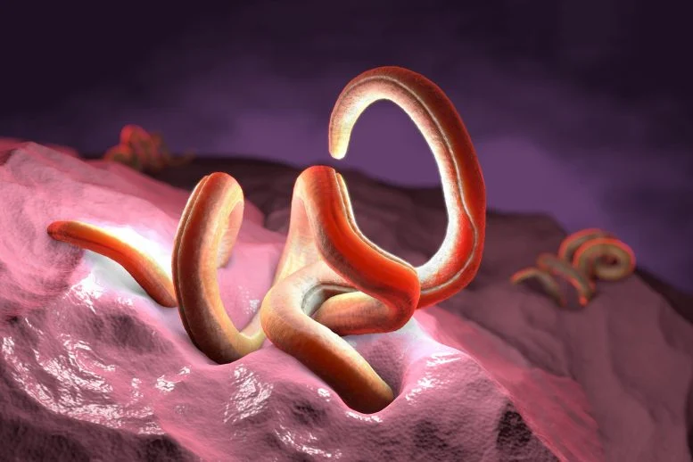 Twisted Nematode Parasitic Worm Inside Intestines 777  215 518 jpg