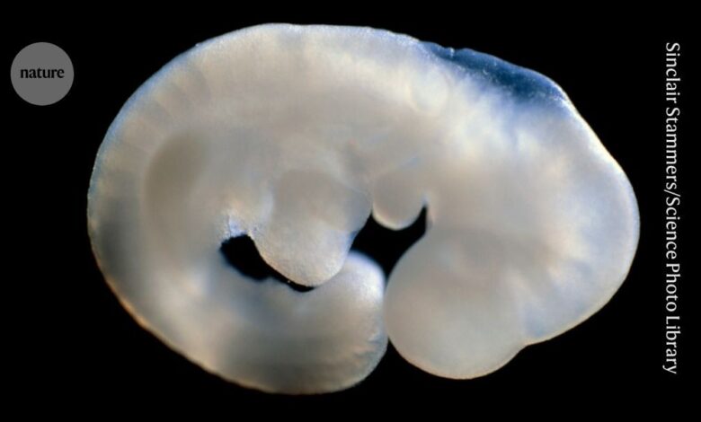 D41586 026 01120 8 52265006 Jpg