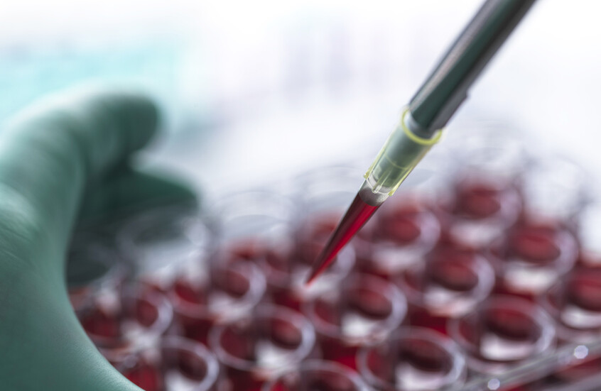 اختراق علمي يغير فهمنا للجهاز المناعي.. آلية مشتركة تجمع بين السرطان وأمراض المناعة الذاتية!