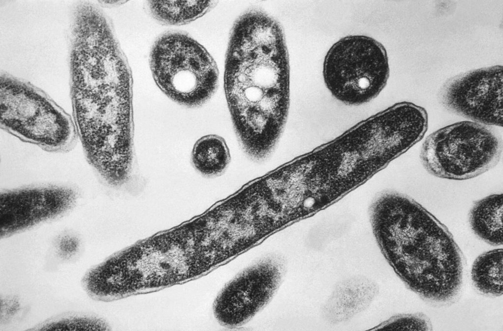 صورة مميزة: ما يجب معرفته عن مرض Legionnaires الذي يصيب الناس بالمرض في مدينة نيويورك