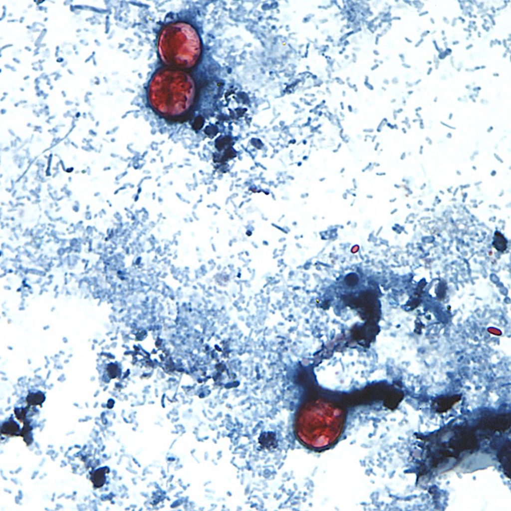 outbreak 1 1024  215 1024 jpg