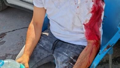 إصابة صهيوني بعملية طعن قرب قرية العوجا في منطقة غور الأردن