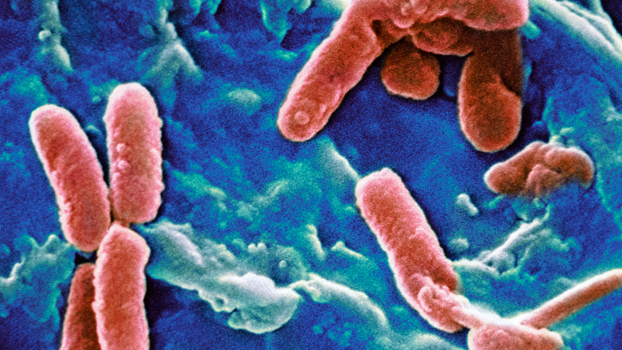 Infectious diseases will seed new ground as the planet warms — here’s where they’ll spread Infectious diseases will seed new ground as the planet warms — here’s where they’ll spread