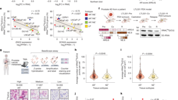 tRNA dosage regulates lineage dependency and resistance in prostate cancer