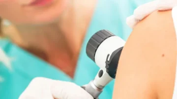 ماسح ضوئي للجلد يعمل بالذكاء الاصطناعي يرصد السرطان المخفي قبل أن يصبح مرئيًا