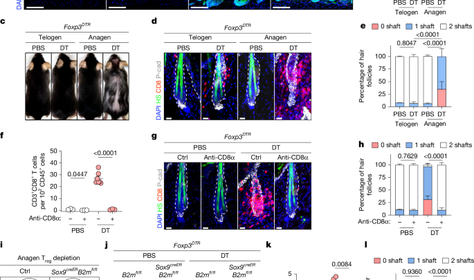 A two-hit mechanism triggers autoimmune hair loss