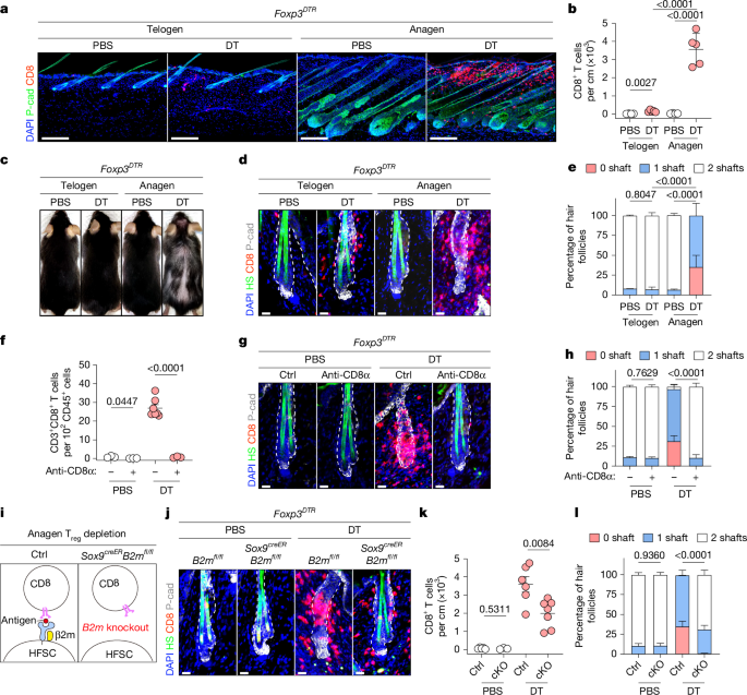 A two-hit mechanism triggers autoimmune hair loss