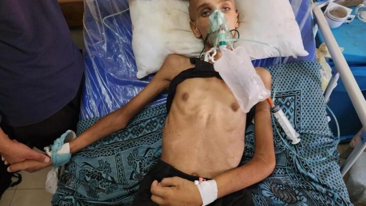 19 خبيرًا أمميًا ينتقدون “فاو” بعد إبعاد مسؤول عارض تجويع غزة