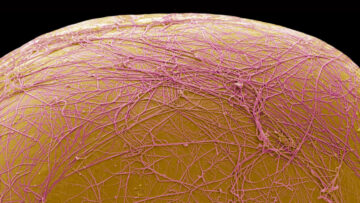 An experimental drug kills fat cells, rather than shrinking them