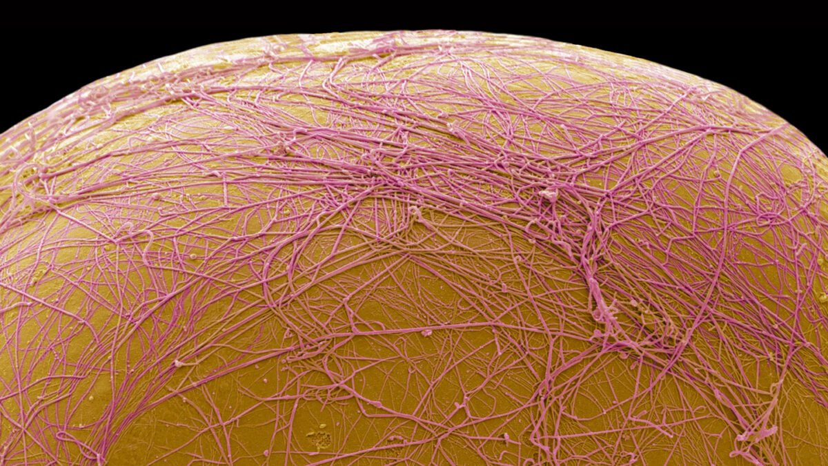 An experimental drug kills fat cells, rather than shrinking them
