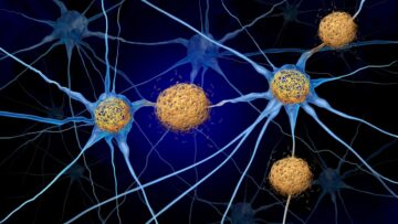 يجد العلماء طريقة لمحاربة تلف الدماغ الناتج عن مرض الزهايمر دون إزالة مادة تاو السامة