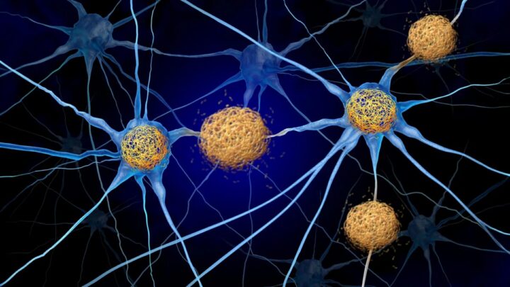 يجد العلماء طريقة لمحاربة تلف الدماغ الناتج عن مرض الزهايمر دون إزالة مادة تاو السامة