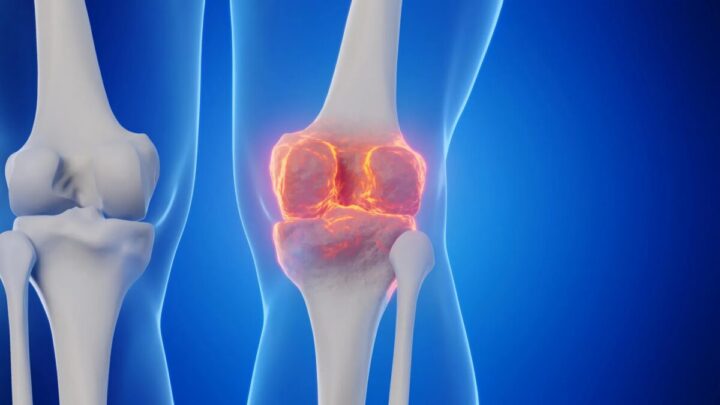 وداعا لاستبدال المفاصل؟ وجد علماء جامعة ستانفورد طريقة لإعادة نمو الغضروف ووقف التهاب المفاصل